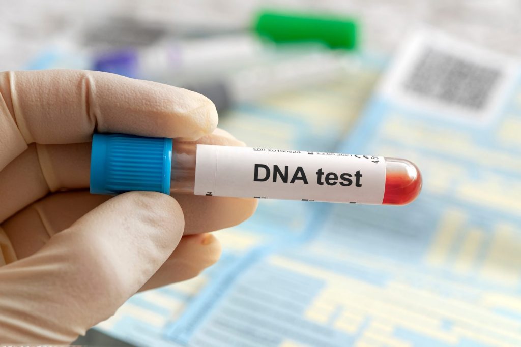 DNA-Testing-scaled-1-1024x683