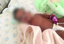 8-month-old baby needs urgent heart surgery
